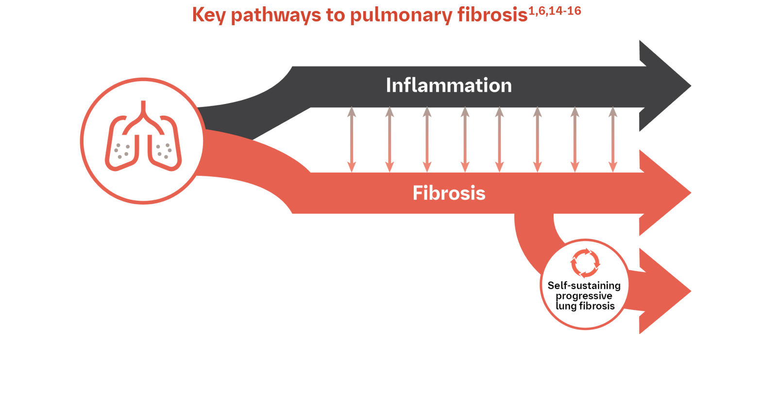 Key pathways to pulmonary fibrosis