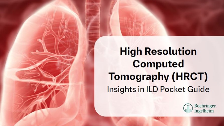 High Resolution Computed Tomography (HRCT) Insights in ILD Pocket Guide Downloadable Resource Thumbnail
