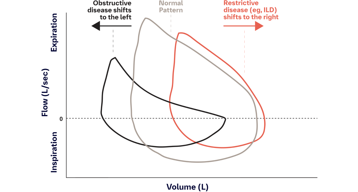 pulmonary function tests results chart