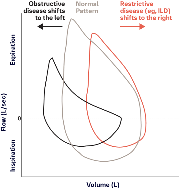 pulmonary function tests results chart pulmonary function tests results chart