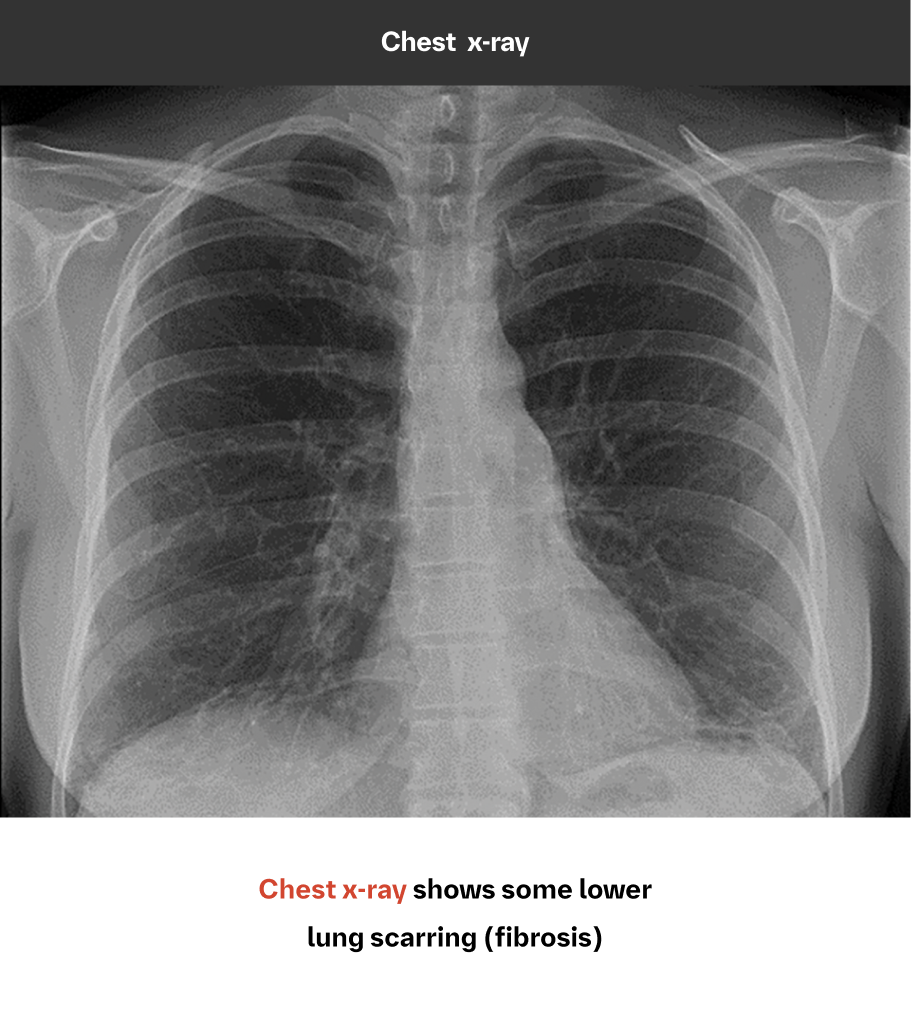 chest x-ray