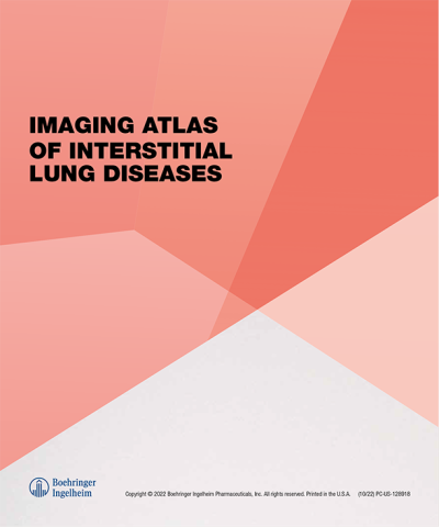 Imaging Atlas of Interstitial Lung Diseases pdf