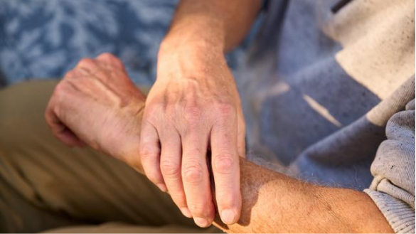 Rheumatoid arthritis-related ILD