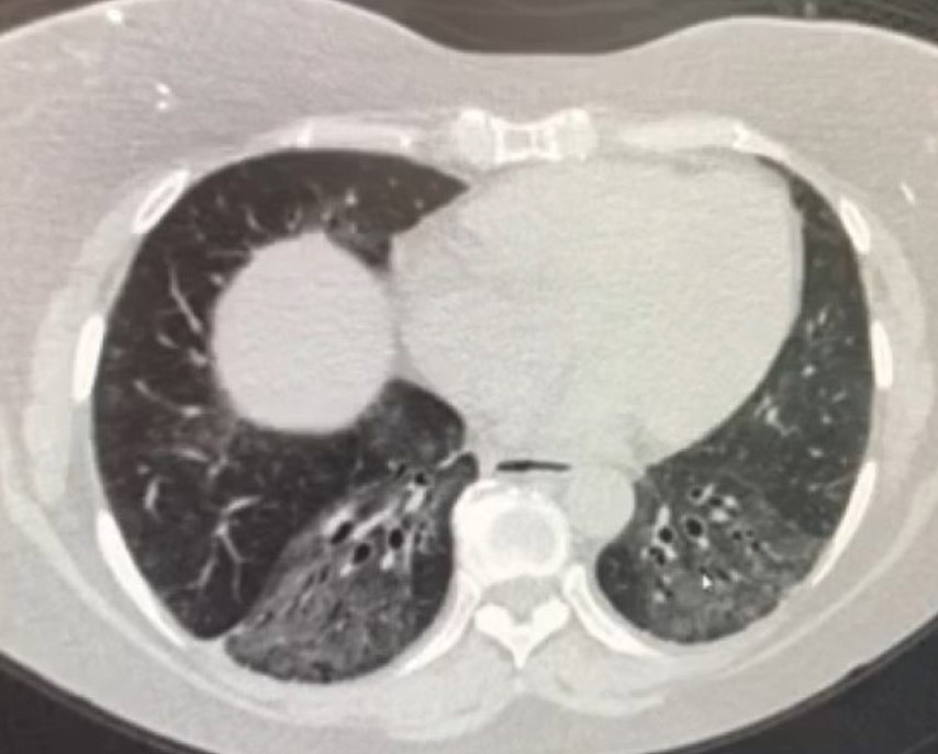 CT scan example