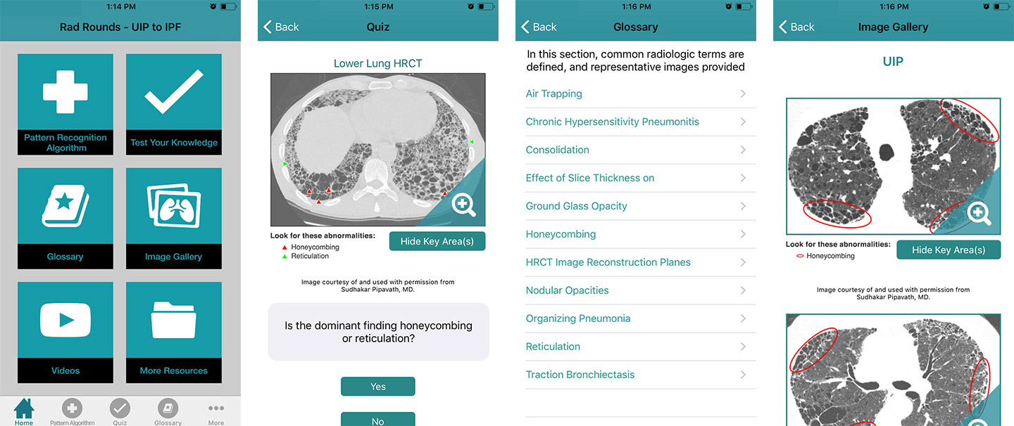 ILD Educational App