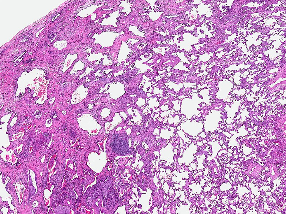 Low magnification photomicrograph Low magnification photomicrograph
