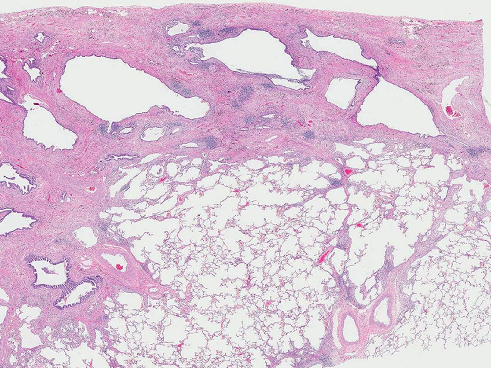 Low magnification photomicrograph Low magnification photomicrograph