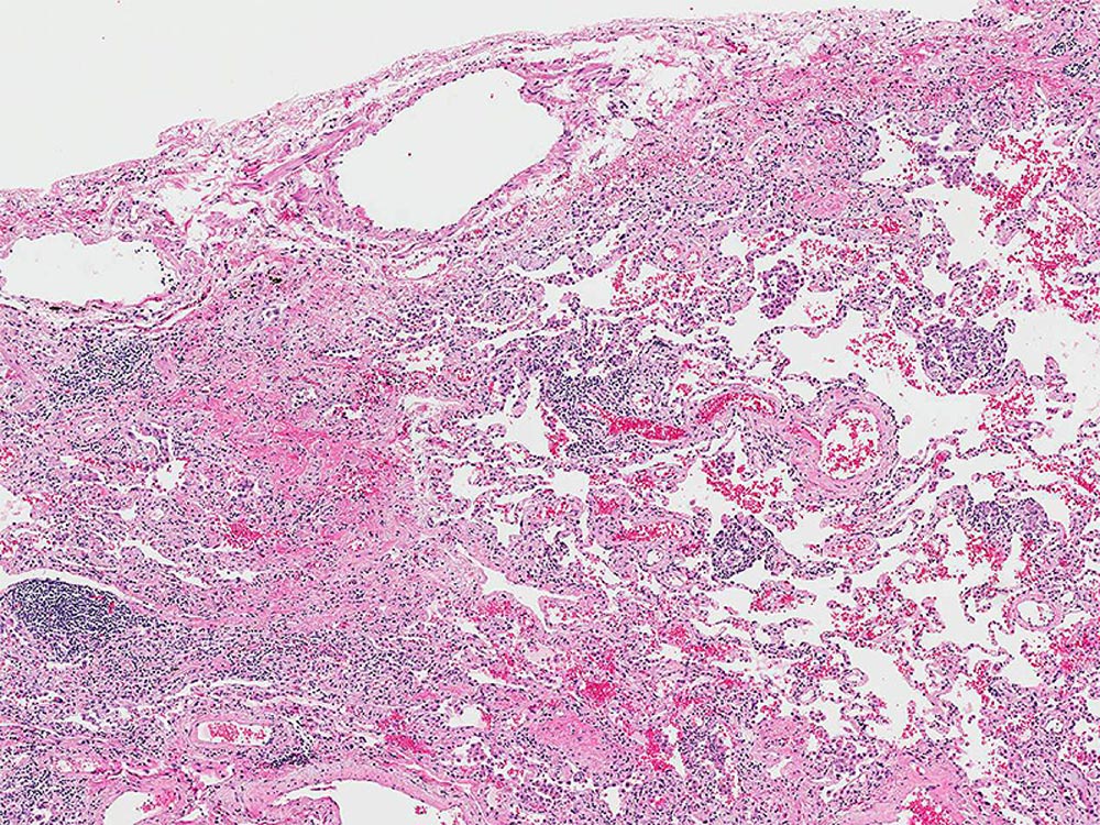 Low magnification photomicrograph Low magnification photomicrograph