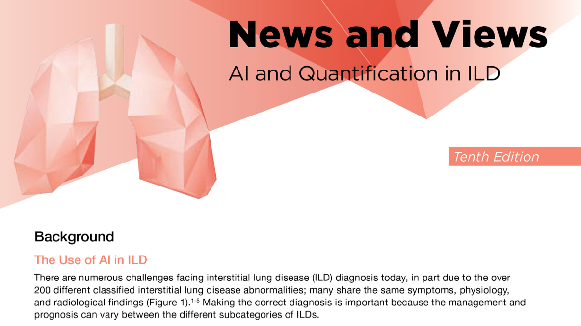 News And Views AI And Quantification In ILD PDF Download