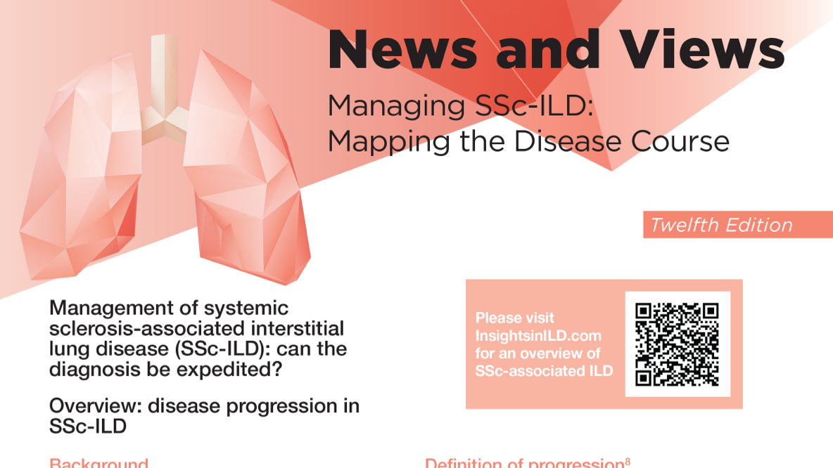 News And Views Managing SSc-ILD PDF Image Download