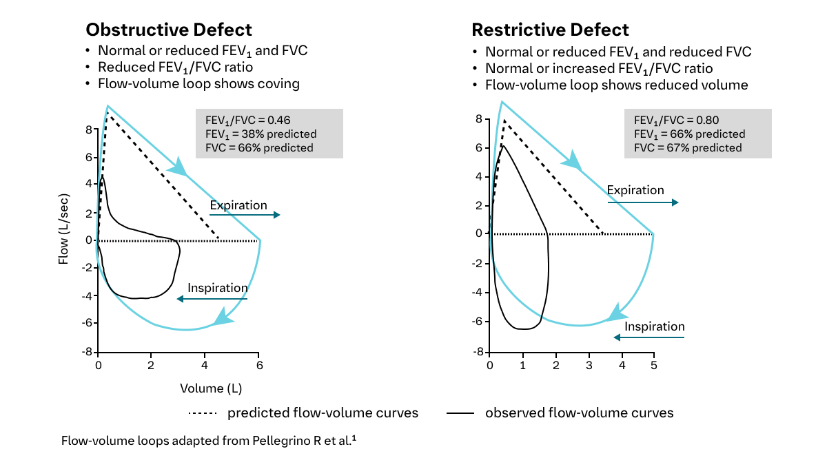 PFTs Help Determine The Type Of Respiratory Defect Present Charts