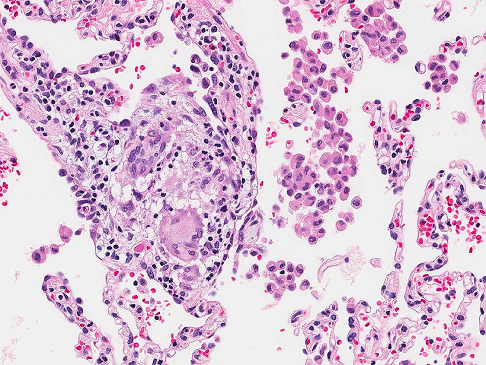 High magnification photomicrograph High magnification photomicrograph