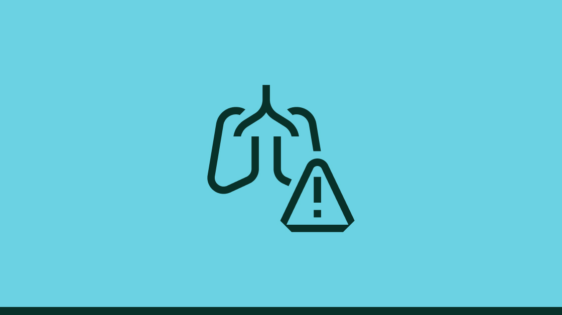 Hypersensitivity Pneumonitis Guidelines