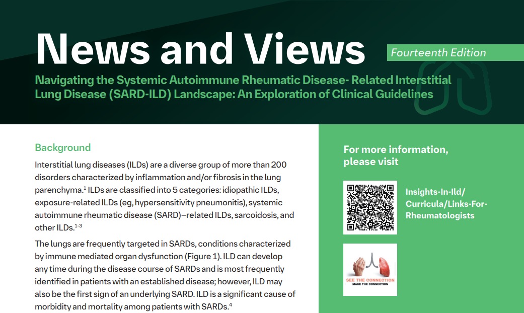 News and views 14th edition