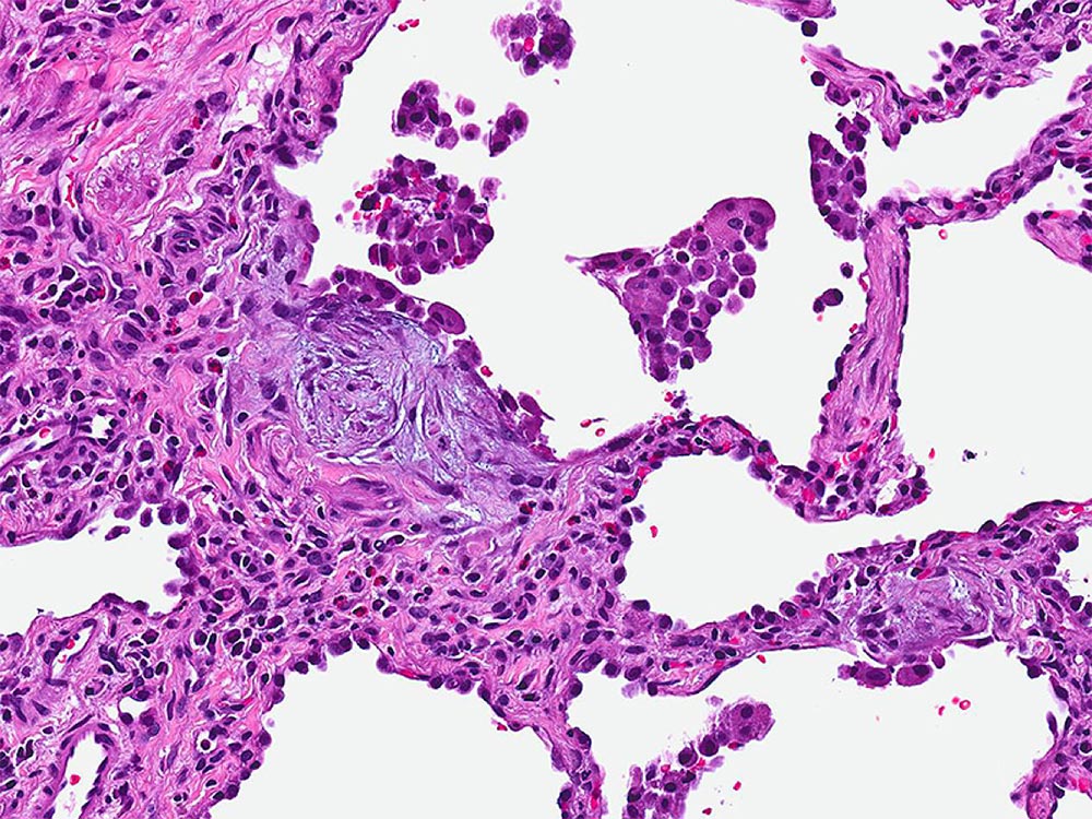 High resolution photomicrograph