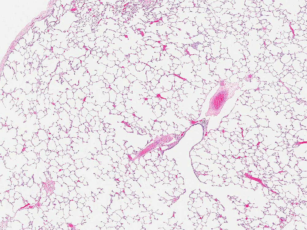 Low magnification photomicrograph