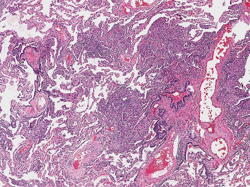 Low-resolution photomicrograph