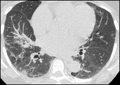 ALTERNATIVE DIAGNOSIS