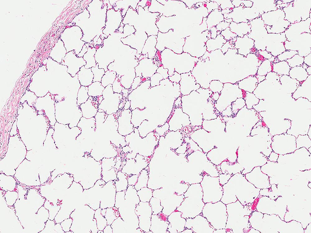 Higher magnification photomicrograph