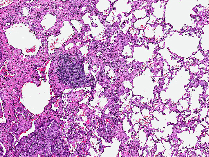 Low magnification photomicrograph
