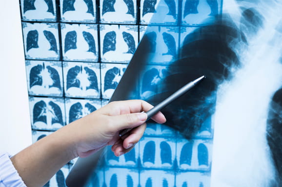 Doctor Pointing Out Specifics of X-Ray