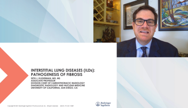 Interstitial Lung Disease: Pathogenesis of Fibrosis